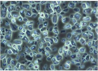 China Distancia de funcionamiento extralarga biológica compuesta del microscopio ELWD del NA 0,3 del condensador en venta