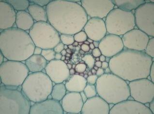 Cina Obiettivi acromatico 4 x 10 x 40 x 100 x del cannocchiale 360 della testa del microscopio rotabile della macchina fotografica digitale in vendita