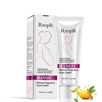 China Whitening Amazon Hot Sale Increase Skin Elasticity Repair Stretch Marks Removal Pregnancy Scar Maternity Cream for sale