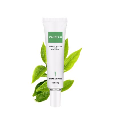 China Wholesale Nature OEM ODM Acne Treatment Private Label Pure Herbal Acne Removing Cleansing Treatment Cleansing Cream for sale