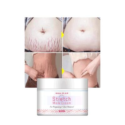 China OEM Pregnancy Scar Private Label Nourishing Mark Cream / ODM Mango Stretch Mark Removal Cream Skin Whitening for sale