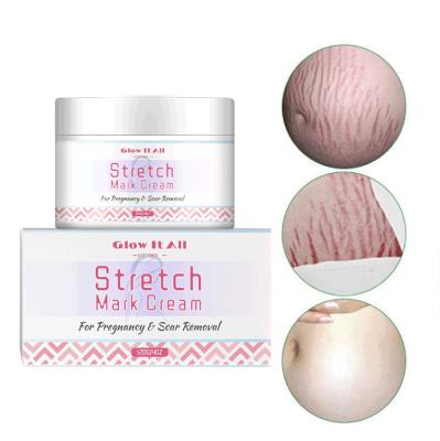 China OEM Amazon Hot Sale Nourishing Organic Scar and Mango Stretch Mark Set Cream For Pregnancy Repair Scar Remove Treatment Body Skin Care for sale