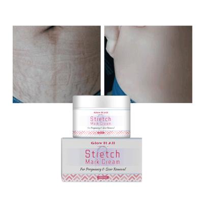 China Natural Organic Nourishing Shea Butter Cream Anti Wrinkle Private Label , Free Sample OEM Skin Brightening Stretch Mark Treatment for sale