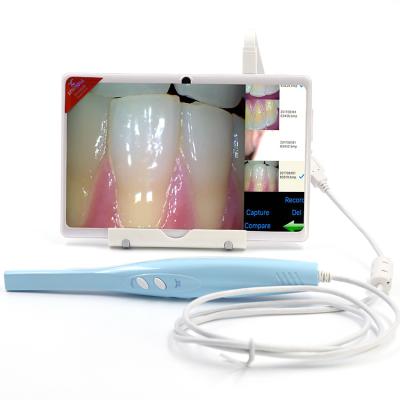 China 2020 New Product Camera Unit Acrylic Tend Dental Implants USB Wire Intra Oral Camera 5 Mega For Dentist for sale