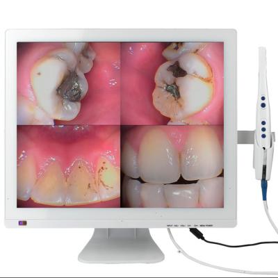 China Reputable Metal 2022 Intra Oral Camera With Monitor Endoscope Camera Dental Intraoral Oral Camera for sale