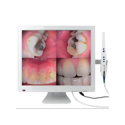 China Hot selling metal 2022 M-998 2-in-1 camera19 inch lcd monitor with dental intraoral camera manufacturer for sale