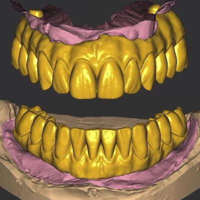 Cina 3 Forma Dental Crown Design / Exocad Implant Design ISO approvato in vendita