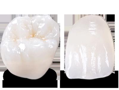 China Emergencia Temporal Emax Puente dental Dentes Emax Restauración en venta