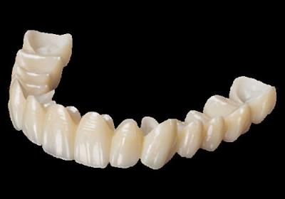 Chine Esthétique élevée Implant de couronne de zirconie à contour complet CAD CAM FCZ à vendre