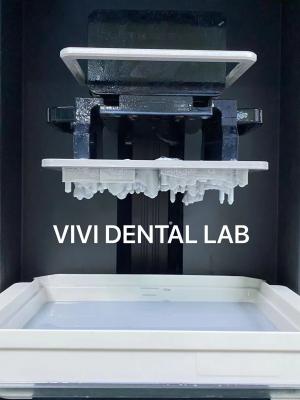 Cina Stampa digitale 3D corone dentali dentale professionale accurato in vendita