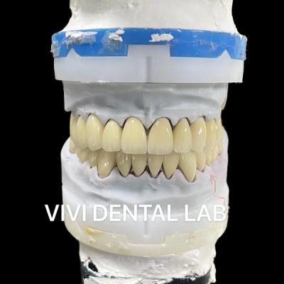 China Coronas digitales de laboratorio dental CAD CAM de zirconía translúcida en capas en venta