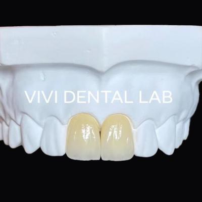 China Coroas de laboratório dentário de precisão Ivoclar Estética Coroas de zircônia de aparência natural à venda