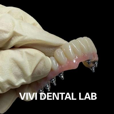 China Implantes de PMMA coroas e pontes temporárias parafusadas em bases de Ti à venda