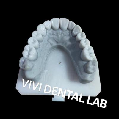 Cina Stabile corone dentale ceretta diagnostica per il trattamento ortodontico in vendita