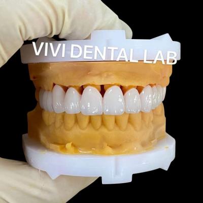 China CE Coronas dentales dentales Niquel libre de berilio VIVI Laboratorio dental en venta