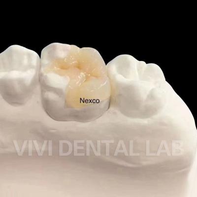 Cina Dental Composite Inlays And Onlays Ivoclar Nexco Alta estetica in vendita