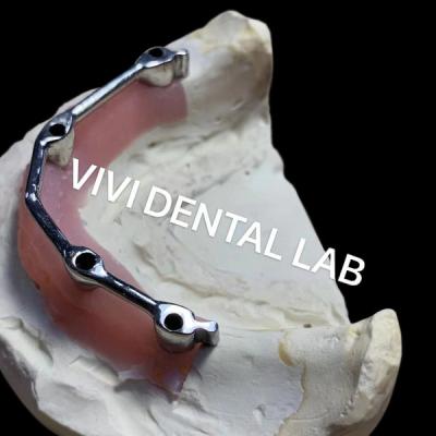 Cina Sheftner Ivoclar Impianto Overdenture Bar Con Preci Attachments Clips Metallici in vendita