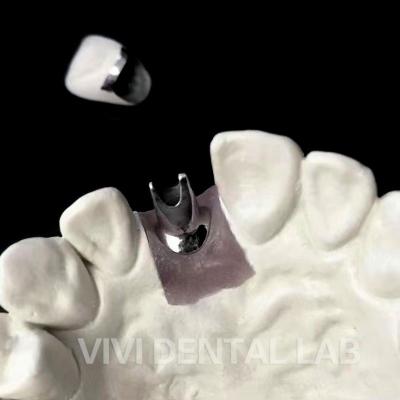 Chine Implants dentaires personnalisés couronne Ni Be Free Abutment de base en titane à vendre