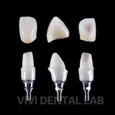 Cina Impianto dentale Tibase Abutment di zirconia Titanio Precisione personalizzata in vendita