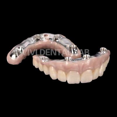 Cina Corona di impianto dentale in zirconia biocompatibile con barra di titanio in vendita