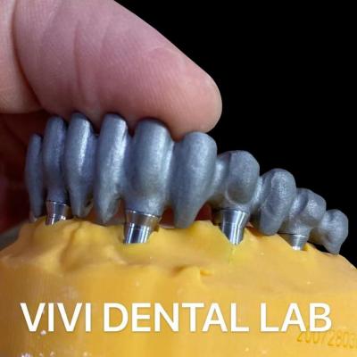 China Imprimido PFM Puente Dental Biocompatible sobre Abutments de Multi Unidad en venta