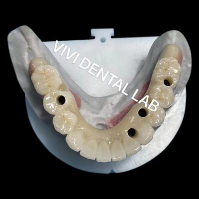 China Multi Layer Zirconia Screw Retained Bridge Biocompatible On Metal Structure for sale