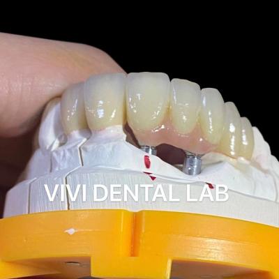 China Porselein Zirconia Tandheelkundige Implantatie Brug Professionele Hoge Esthetiek Te koop