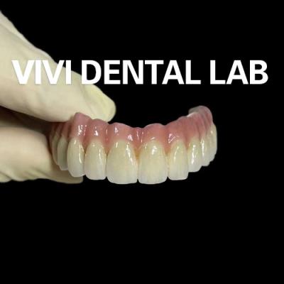 Cina Implantazione dentale digitale corona e ponte estetica personalizzata in vendita