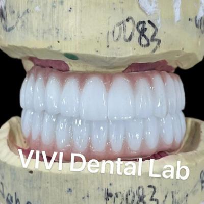 China Ni ser libre Zirconia puente de implantes dentales en la barra alta estética en venta