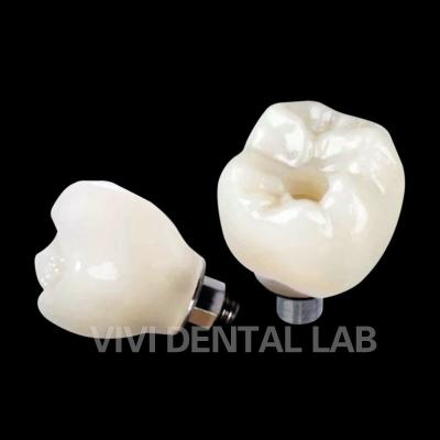 Cina Croce di impianto dentale a vite PFZ in porcellana stratificata in zirconia in vendita