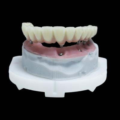 China All On 4 PFM Dental Implant Crown Titanium Zirconia All On 6 Restorations for sale