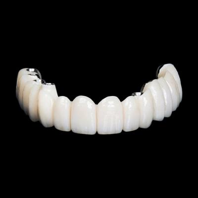 China Accuracy Dental Implant Crown Restorations Professional FDA Certified for sale