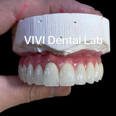 Cina Ponte dentali in metallo ceramica avvitata e trattenuta con tronco in vendita