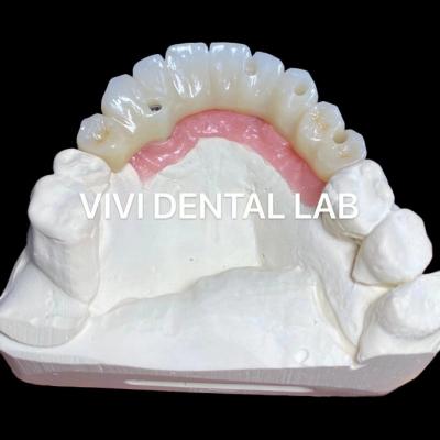 Cina Accuratezza PMMA Full Zirconia Bridge Over Multi Unit Abutments in vendita