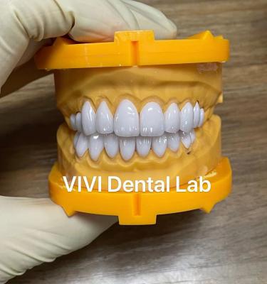 China La lamina de Ivoclar Emax chapea el laboratorio dental de China de la alta translucidez en venta