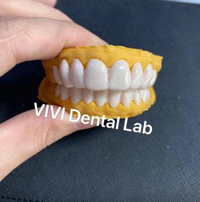 China Dental Snap On Smile Veneers Alta estética Certificado por la FDA en venta