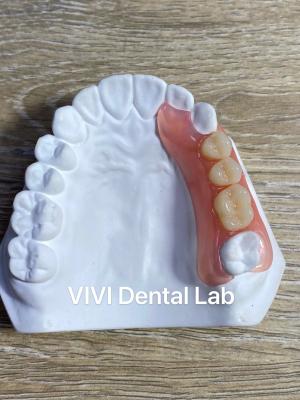 China Hoge esthetiek Flexible Acrylic Partial Denture / Valplast Dental Partials Te koop