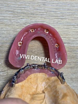 Cina Dental Bar Implantazione assistita Protesi dentali Alta estetica Buona vestibilità con accessori in vendita