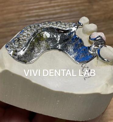 China Impressão a laser Cobalto Cromo Quadro de Dentadura Parcial Ni Ser Livre à venda