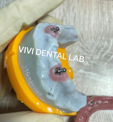 Cina Ivoclar Implant Ball Attachments Materiale rimovibile per impianti dentali per igiene orale in vendita