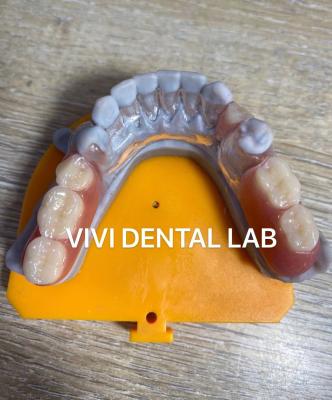 China Flexibles Cuadros de dentadura parcial de metal transparente Alta estética en venta