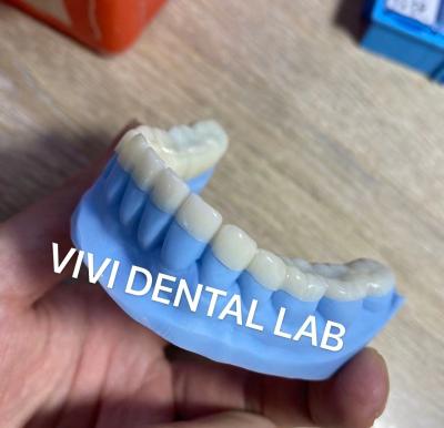 China Diseñado para que los dientes tengan una mordedura más vertical en venta