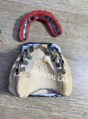 Cina Dental Implant Bar Supported Dentures Precise Per Edentulous in vendita