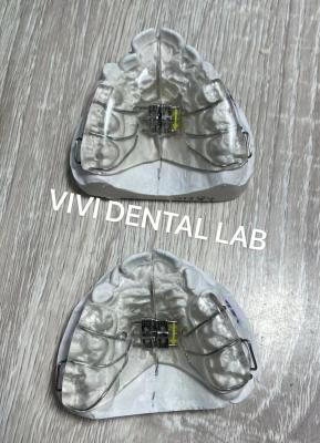 China Arco de parafuso Dentes Dentários Expansor do Palato Tipo Ortopédico Removível à venda