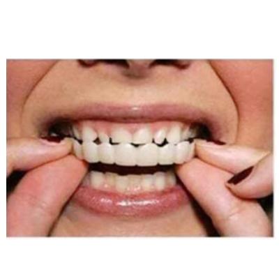 China Truelybeauty Amazon Smile Perfect Detachable Braces Hot Selling False Teeth Plates Teeth False Teeth Braces TB171 for sale