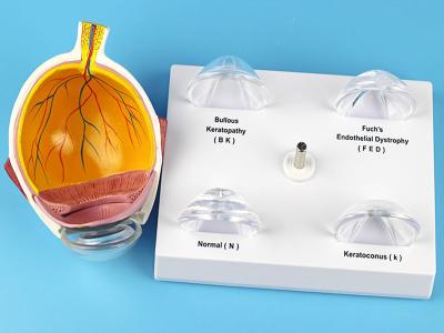 중국 인간 안구 백내장 해부학 의학 사람의 눈 해부학 모형 판매용