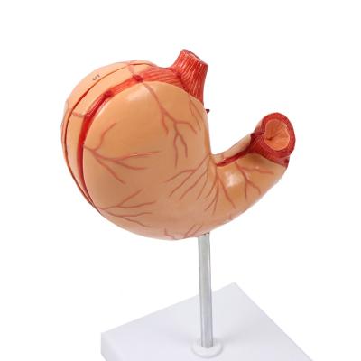 China Modelo de enseñanza de la anatomía de los órganos humanos del estómago enfermo gástrico de alta calidad de la disección en venta