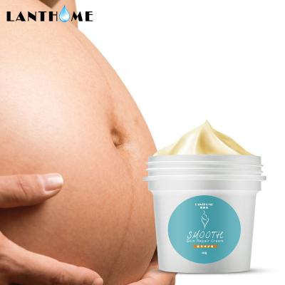 China Skin Revitalizer Lanthome Stretch Mark Remover Cream Pregnancy Stretch Best Stretch Mark Removal Cream Anti Scar Skin Mark Removal Repair for sale