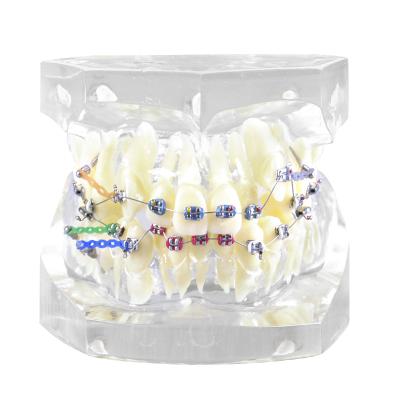 China Nilong Custom Rapid Prototype Dental Model Making Resin 3D Printing Service Biocompatible Materials for sale