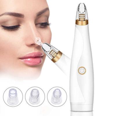 China Portable Multifunction Electric Blackhead Remover 3-in-1 Pore Beauty Acne Remover 3-in-1 Suction Dry Battery Suction Acne Restorer Large for sale